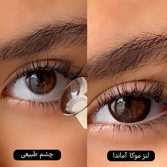 لنز قهوه ای تیره دوردار موکا اماندا کد 529