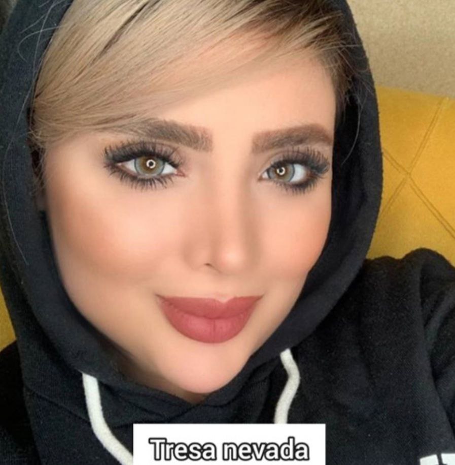 لنز طوسی مرکز عسلی نوادا ترسا کد 852