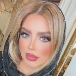 لنز اتلانتیس هیزل اماندا روی چشم مشکی لنز اتلانتیس هیزل اماندا روی چشم مشکی