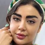 لنز باربی گرین آماندا روی چشم سیاه لنز باربی گرین آماندا روی چشم سیاه