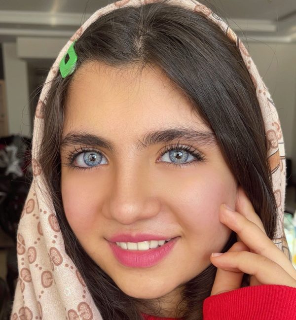 لنز آبی پنج بعدی رگه نقره ای جورجیا بلو آماندا
لنز آبی پنج بعدی رگه نقره ای جورجیا بلو آماندا