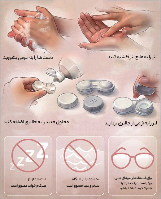 راهنمای استفاده از لنزرنگی