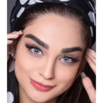 لنز انجل سلنا روی چشم تیره لنز انجل سلنا روی چشم تیره
