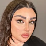 لنز یوتا سلنا روی چشم مشکی لنز یوتا سلنا روی چشم مشکی