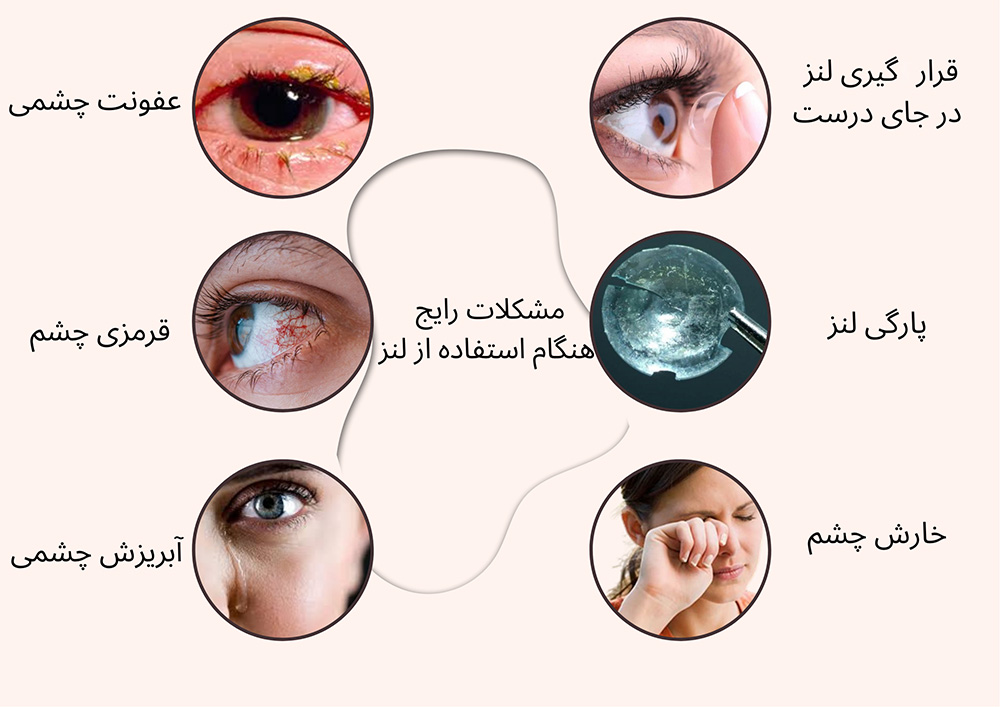 مشکلات رایج هنگام استفاده از لنز رنگی