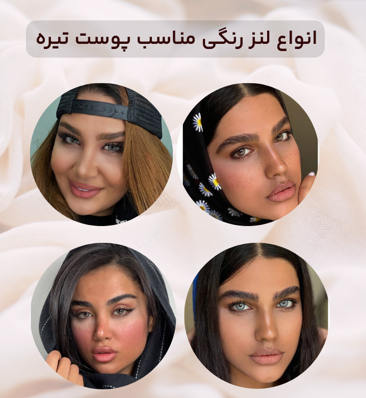 انواع لنز رنگی مناسب پوست تیره