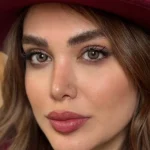 لنز رنگی قهوه ای عسلی دور مشکی آلیس براون رز لنز رنگی قهوه ای عسلی دور مشکی آلیس براون رز