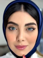 unique-sky-fall-on-eyes لنز آبی اقیانوسی اسکای فال یونیک روی چشم با رنگ آبی اقیانوسی متمایل به سبز و دور ظریف